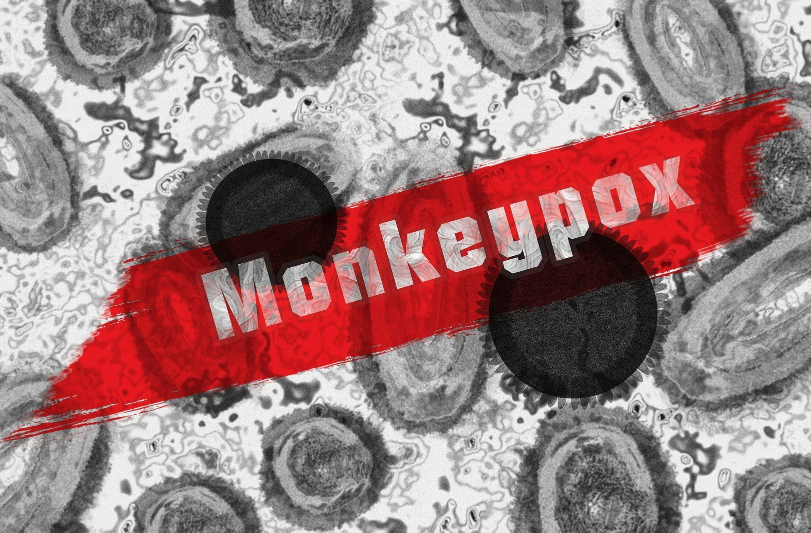 monkeypox virus